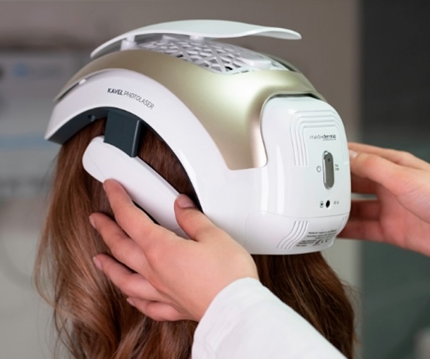 Tratamiento photolaser la caida del pelo